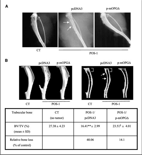 Figure 1 From Therapeutic Relevance Of Osteoprotegerin Gene Therapy In