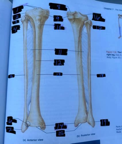 Lab Exam A Fibula And Tibia Flashcards Quizlet