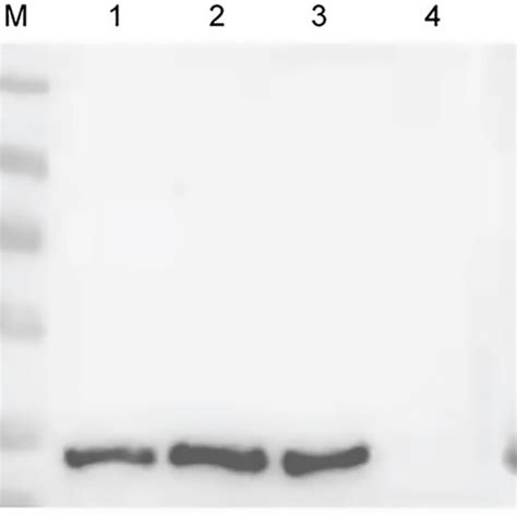 Immunoprecipitation Showing The Human C Q Was Pulled Down By The Native