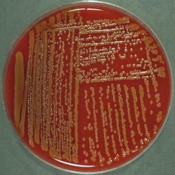 Serratia marcescens