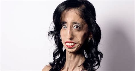 How Being Called The Worlds Ugliest Woman Transformed Her Life