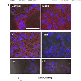 TauT Knockdown Impairs Cytotrophoblast Morphological Differentiation In