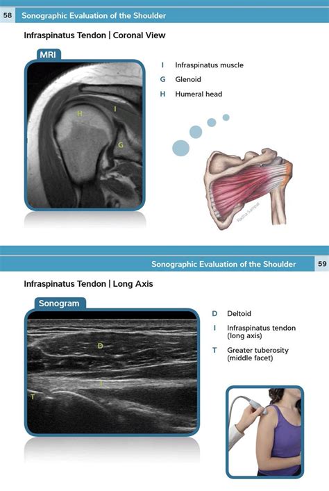 Sᴡɪss Uʟᴛʀᴀsᴏᴜɴᴅ Cᴇɴᴛᴇʀ Uzr On Twitter Free Musculoskeletal Ultrasound Pocket Guide