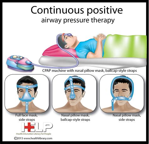 Continuous Positive Airway Pressure Therapy | Nursing information ...