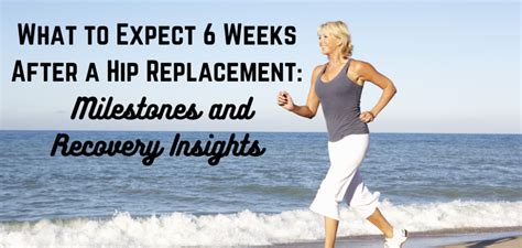 What To Expect 6 Weeks After A Hip Replacement Milestones And Recovery