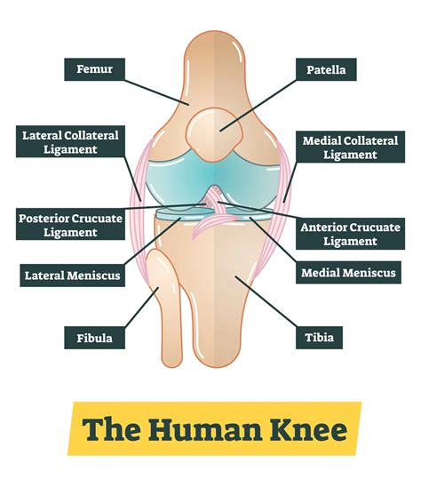 Medial Meniscus Tear