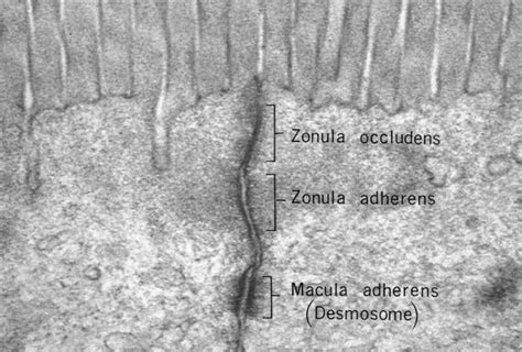 Tight Junctions Desmosomes Gap Junctions