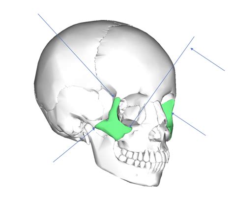 Zygomaticmalar Bone Diagram Quizlet