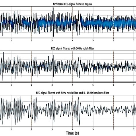 From Top To Bottom Unfiltered Electroencephalography Eeg Signal Eeg