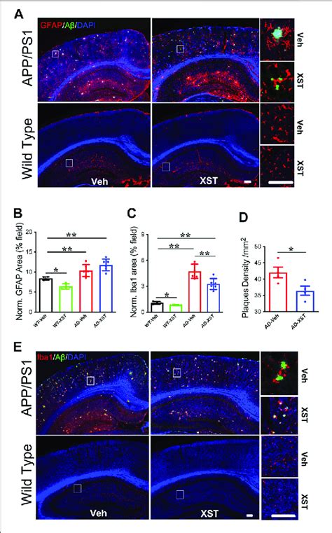 Effect Of Xst On Aβ Removal From The Brains Of App Ps1 Mice A