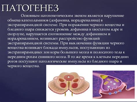 Болезнь Паркинсона - презентация онлайн