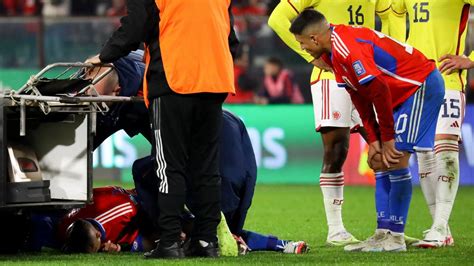 El Drama De Arturo Vidal El Tiempo Que Tardar En Recuperarse De Su