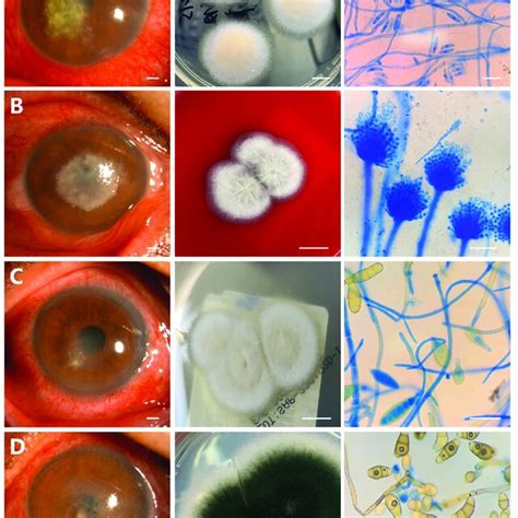 Anterior Segment Photography Colonies Morphology And Lactophenol Blue Download Scientific