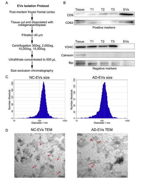 Characterization Of Extracellular Vesicles Evs Isolated From