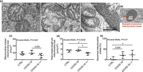 Mitochondrial cristae density and morphology in PBMCs. (a ...