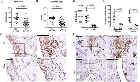 Increased Expression Levels Of Sox In Ra Synovium A Real Time Pcr