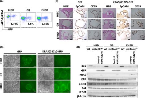 Establishment Of Mouse Biliary Epithelial Cells BECs Organoids