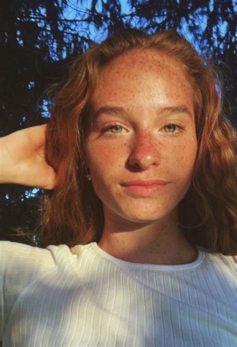 Sun Freckles R Freckledgirls