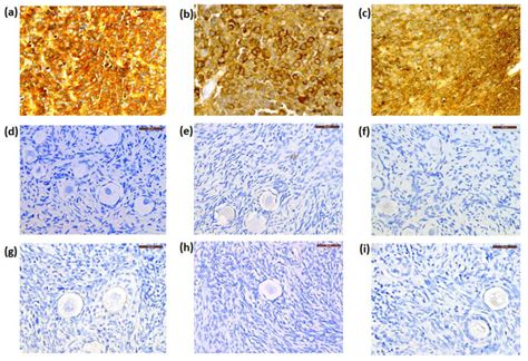 Representative Photos Of Immunostaining For Neuron Specific Enolase