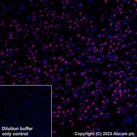 Wilms Tumor Protein重组抗体[can R9 Ihc 56 2] Wilms Tumor Protein抗体 Ab314587