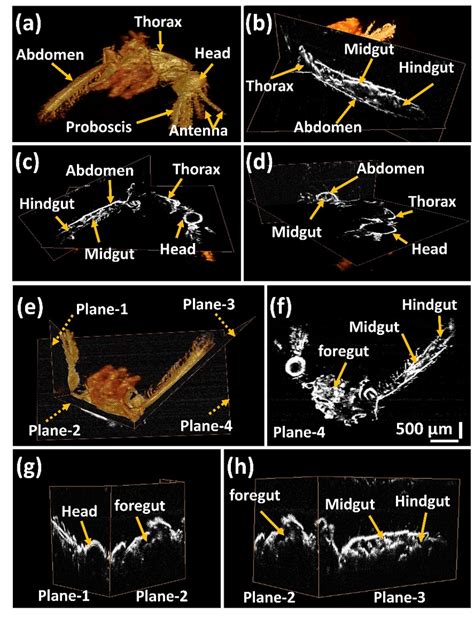 Three Dimensional Optical Coherence Tomography 3d Oct Image Of A Download Scientific Diagram