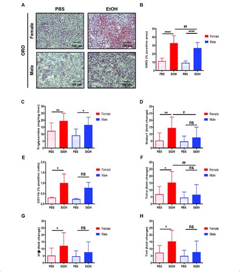 Hepatic Lipid Accumulation And Inflammation Are Characteristic Of