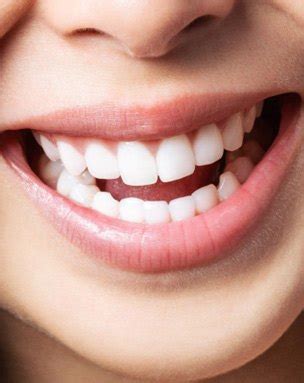 Lanap Laser Surgery Encinitas Ca Gum Disease Treatment Periodontist