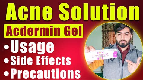 Best Gel For Acne Treatment Pimple Solution Acdermin Gel Use Side Effects Beauty Facts