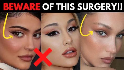 Why You Ll Regret Getting This Trendy Plastic Surgery Procedure Fox