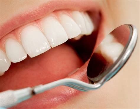 Qué es una endodoncia y cuáles son sus causas