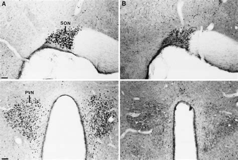 Photomicrographs Of Fos Immunoreactivity In The Supraoptic Son Top