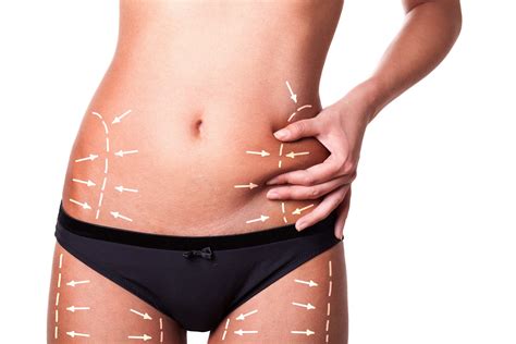 Whats The Difference Between Liposuction And A Tummy Tuck