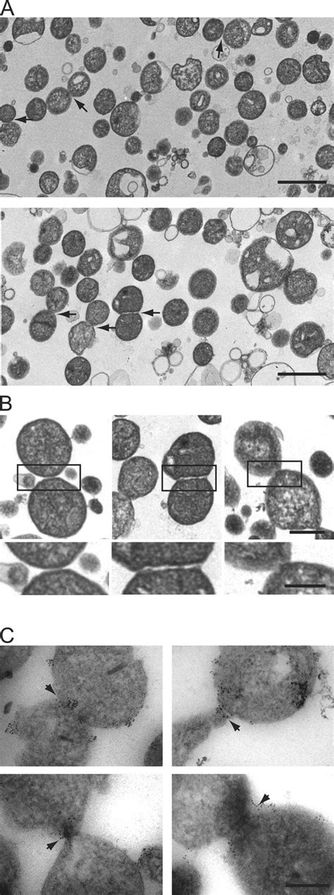 Identification Of Mitochondrial Outer Membrane Fusion Intermediates