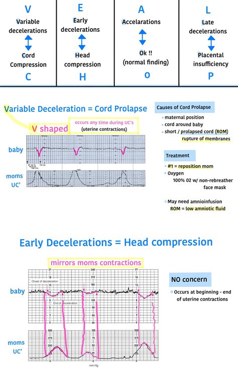 Fetal Heart Rate Interpretation Fetal Heart Strips Labor And Delivery Cheat Sheet Ob Nursing