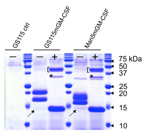 SDS PAGE Analysis Of GS115 GS115mGM CSF And Man5mGM CSF Culture