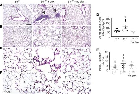 JCI Insight β1 Integrin regulates adult lung alveolar epithelial cell