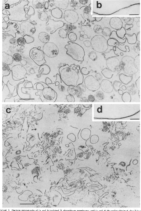 Figure From A Membrane Cytoskeleton From Dictyostelium Discoideum I