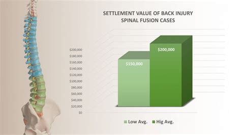 Average Settlement For Spinal Fusion Compensation Payouts