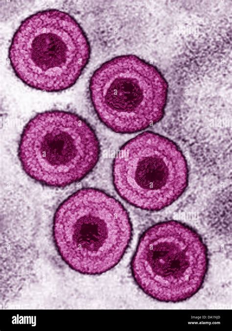 Varicella Zoster Virus Hi Res Stock Photography And Images Alamy