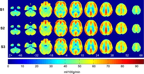 MNI Normalized Images Of Group Averaged N 7 Whole Brain Resting