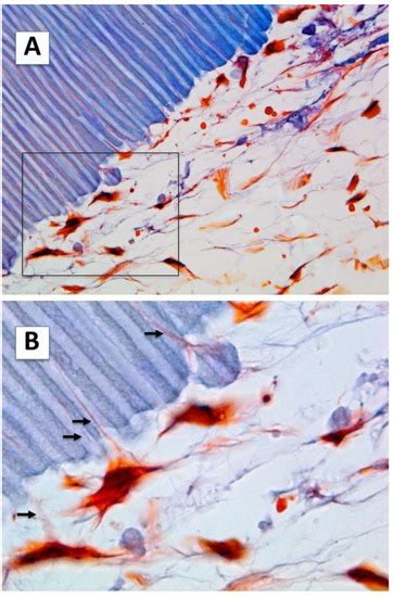 Ijms Free Full Text Human Dental Pulp Stem Cells Differentiate Into