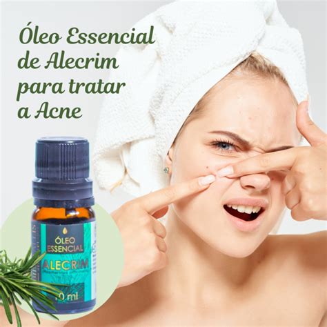 Como tratar a Acne Óleo Essencial de Alecrim Ambientallis