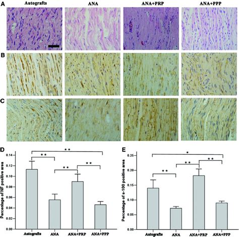 Improved Peripheral Nerve Regeneration Using Acellular Nerve Allografts