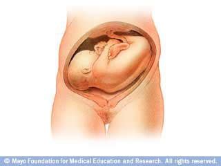 Ob The Newborn Nutrition Breastfeeding Exam Ob C Section