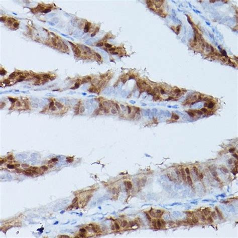 Anti Phospho Erk1 T202 Y204 Erk2 T185 Y187 Antibody Produced In Rabbit