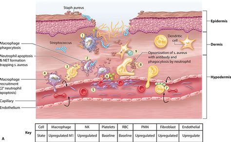 Healing Response In Acute And Chronic Wounds Plastic Surgery Key