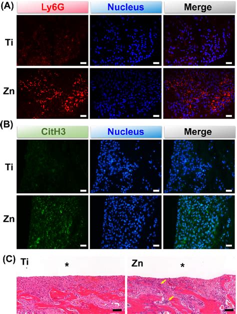 Immunofluorescence Images Of A Ly6G Neutrophils Marker Red And B