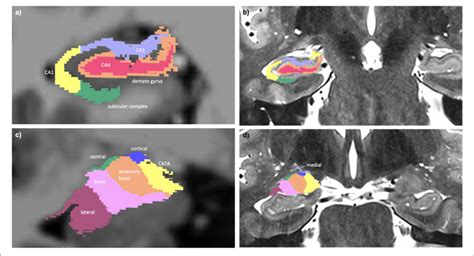 A Multi Spectral Hippocampal Subfield Segmentation CA1 CA3 CA4