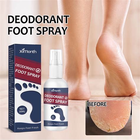 Fankiway Foot And Heel Balm Spray For Dry And Cracked Feet And Heels Foot