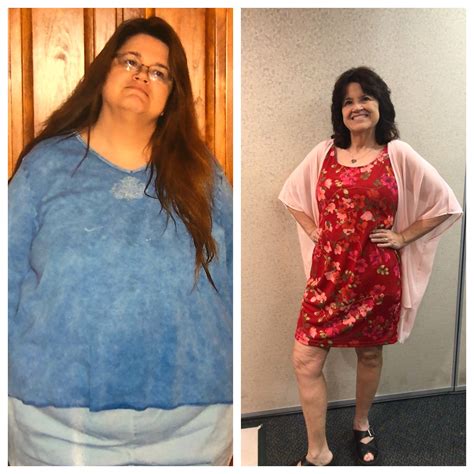 F 58 5’4”[271lbs 151lbs 120lbs]from Morbid Obesity To Fit Progresspics